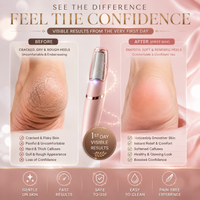 Rechargeable Electric Pedi Foot Filer